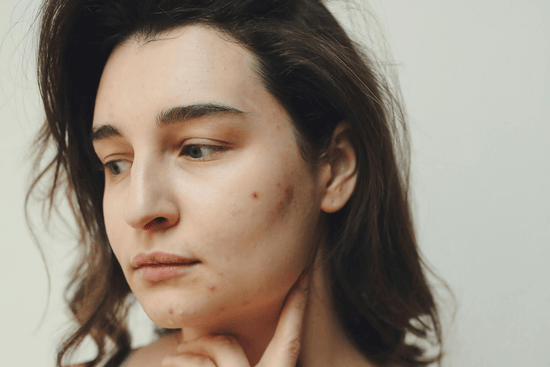 how to know if you have pcos