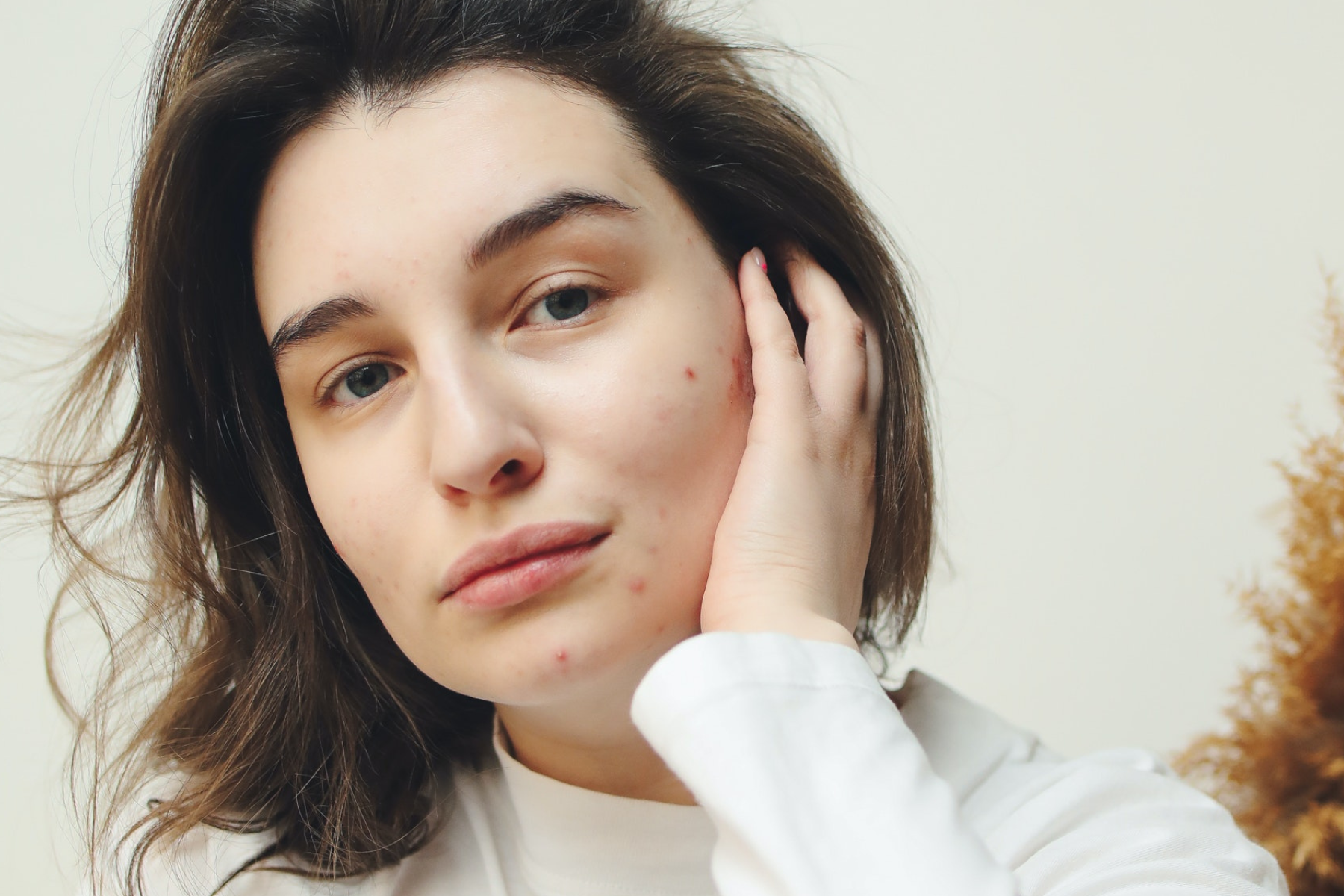 what is PCOS?